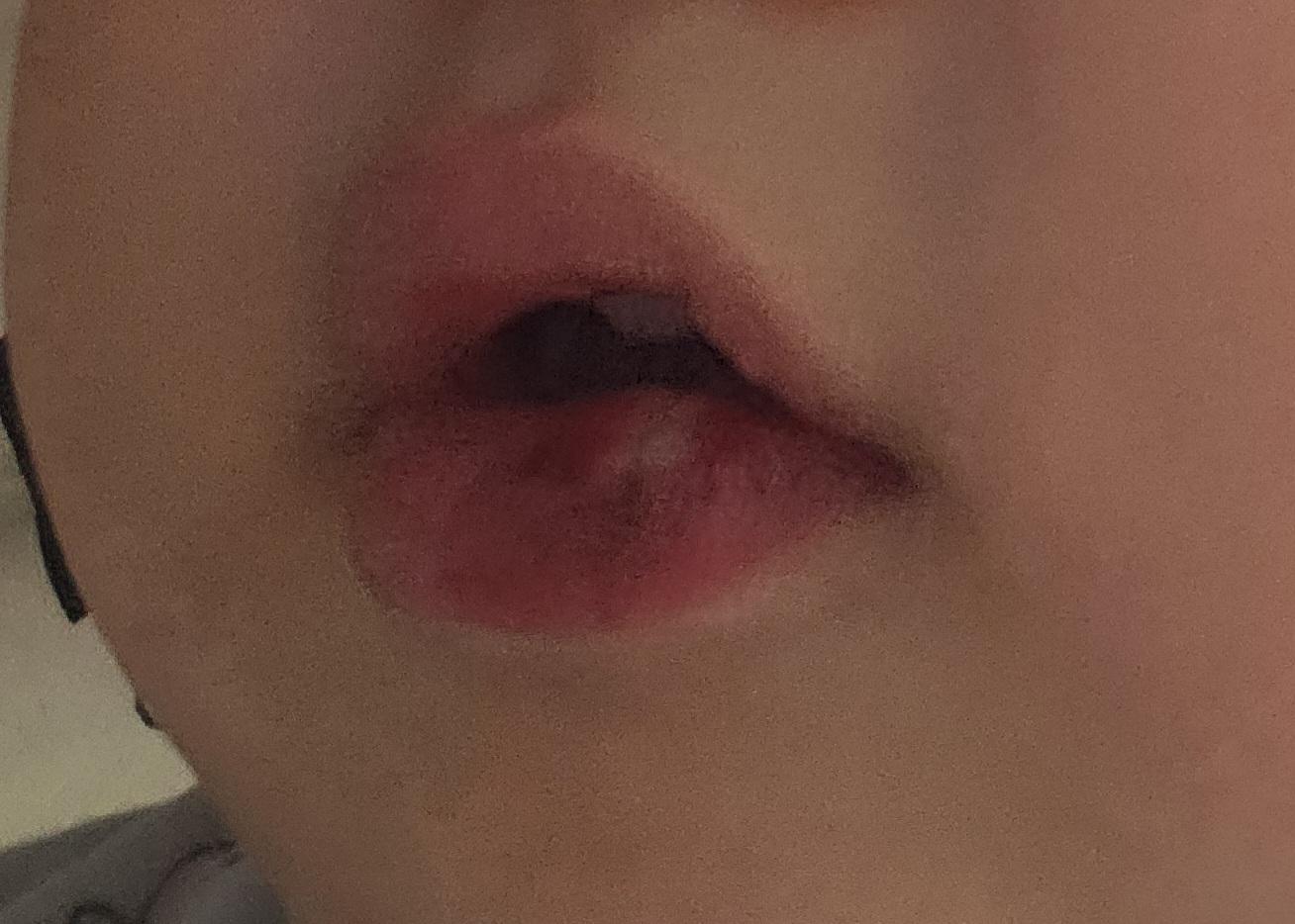 2번 째 사진