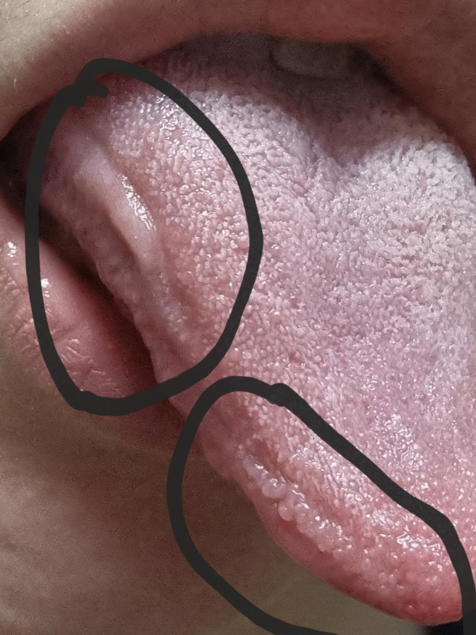 2번 째 사진