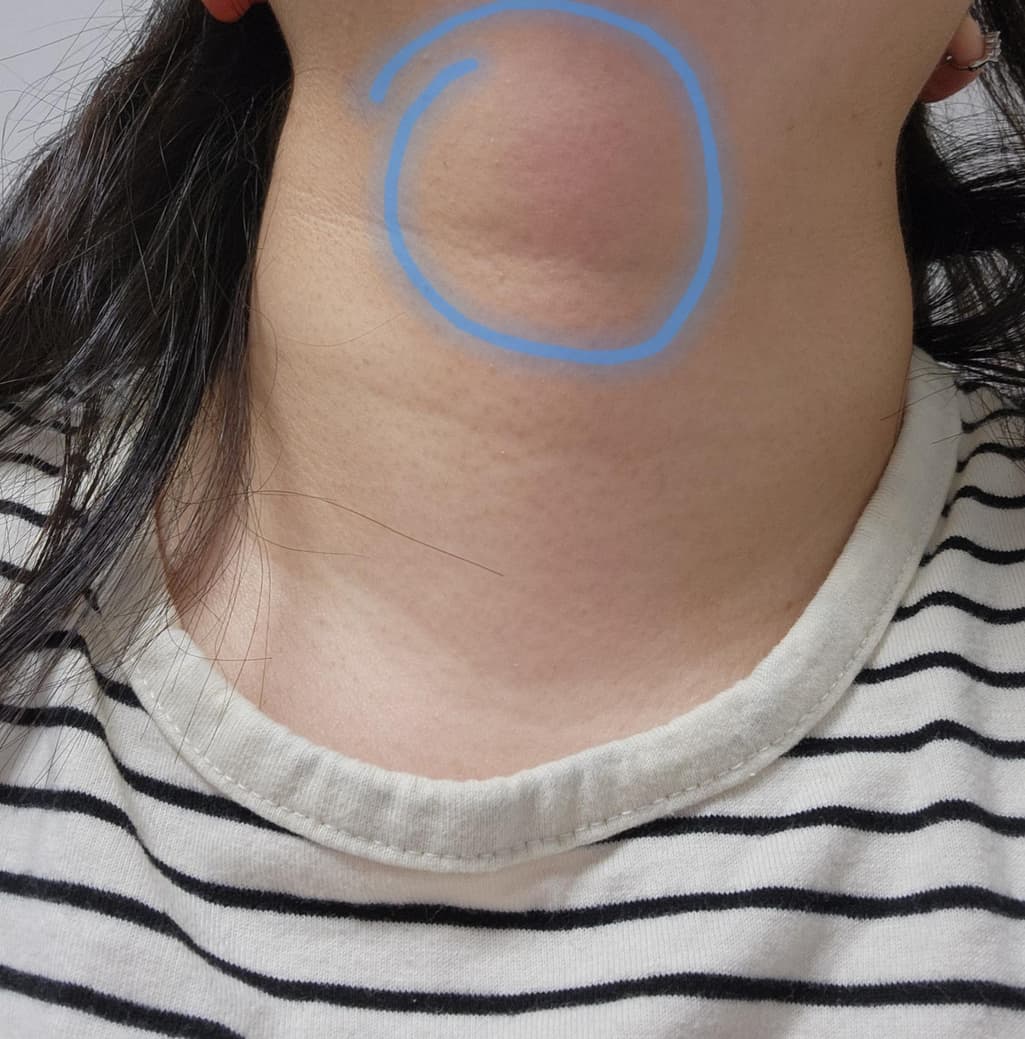2번 째 사진