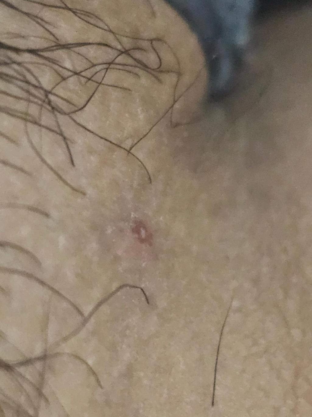 2번 째 사진