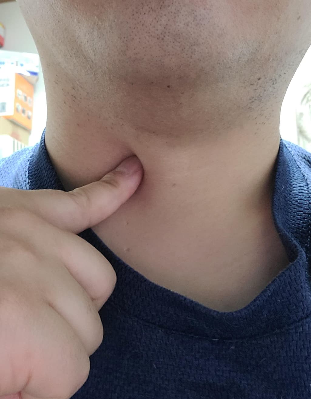 1번 째 사진