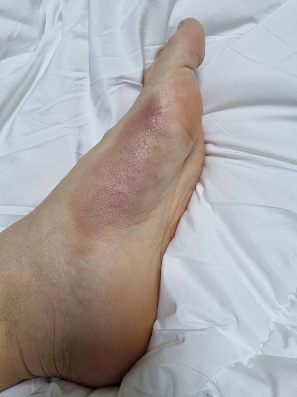 2번 째 사진