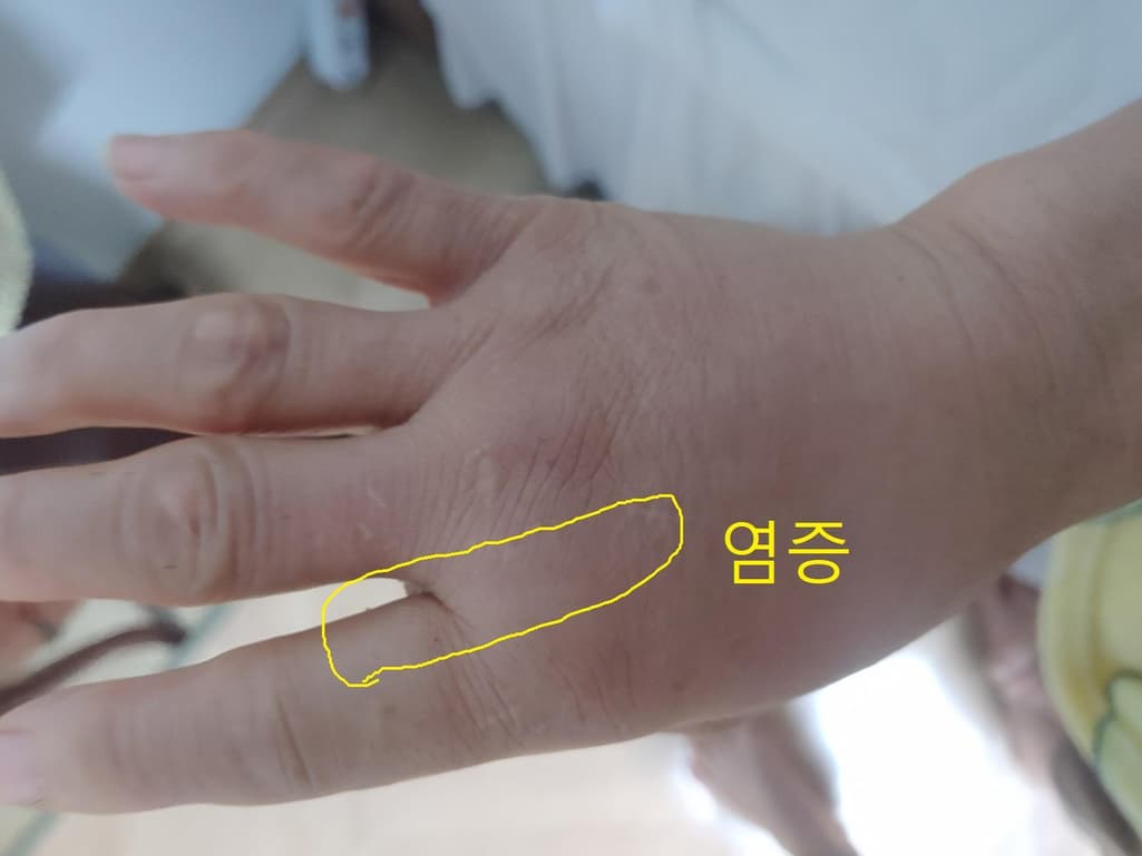 2번 째 사진