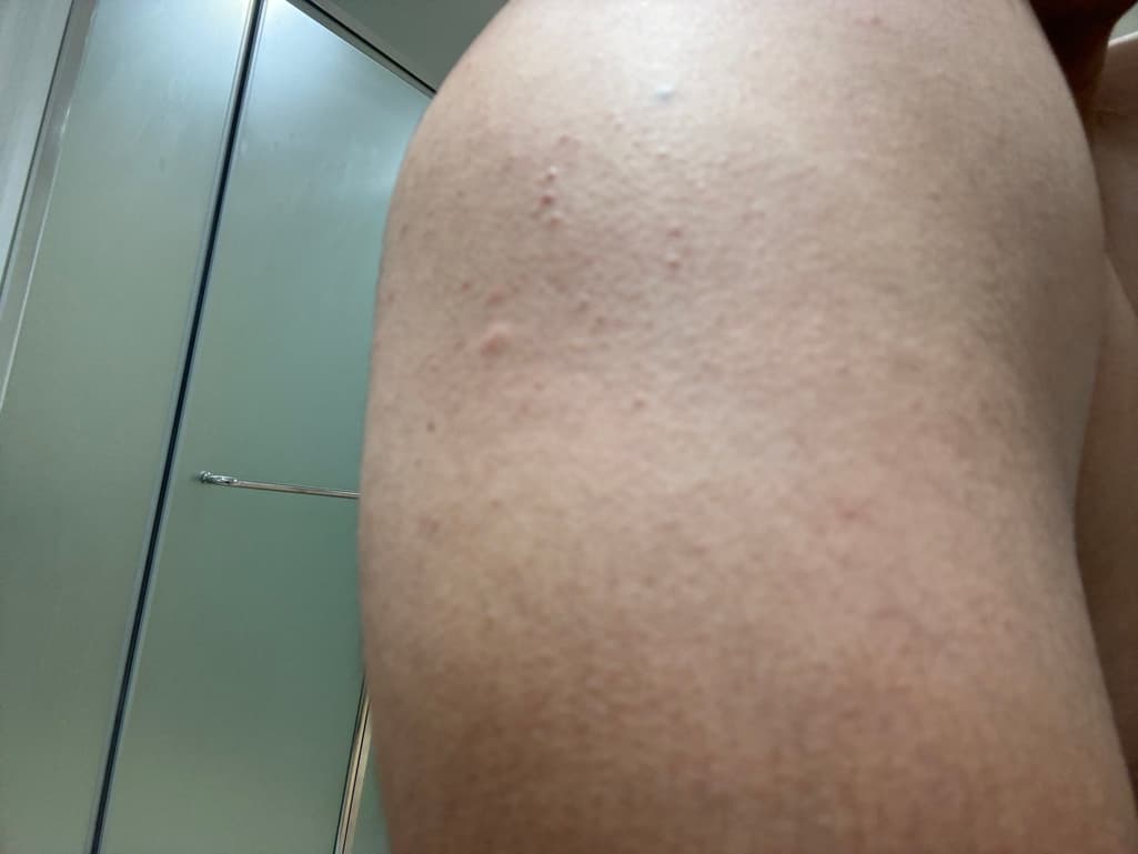 2번 째 사진