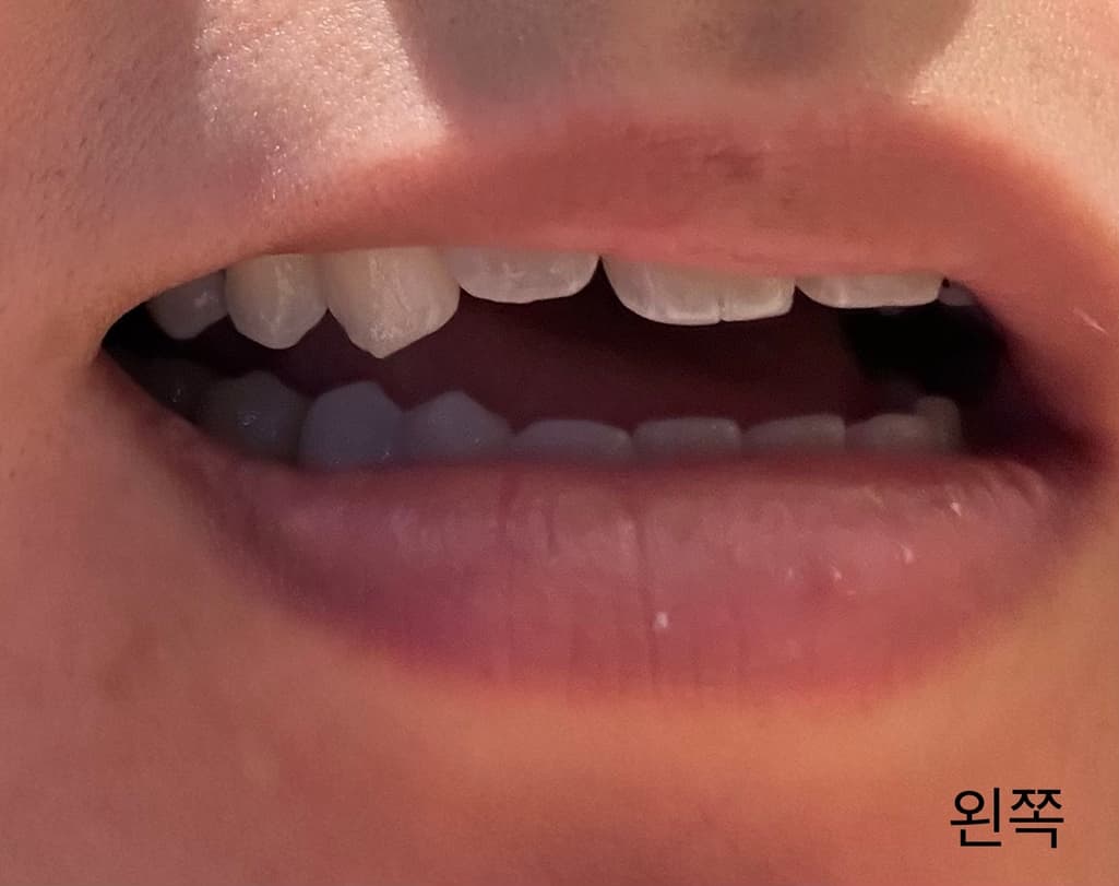 3번 째 사진