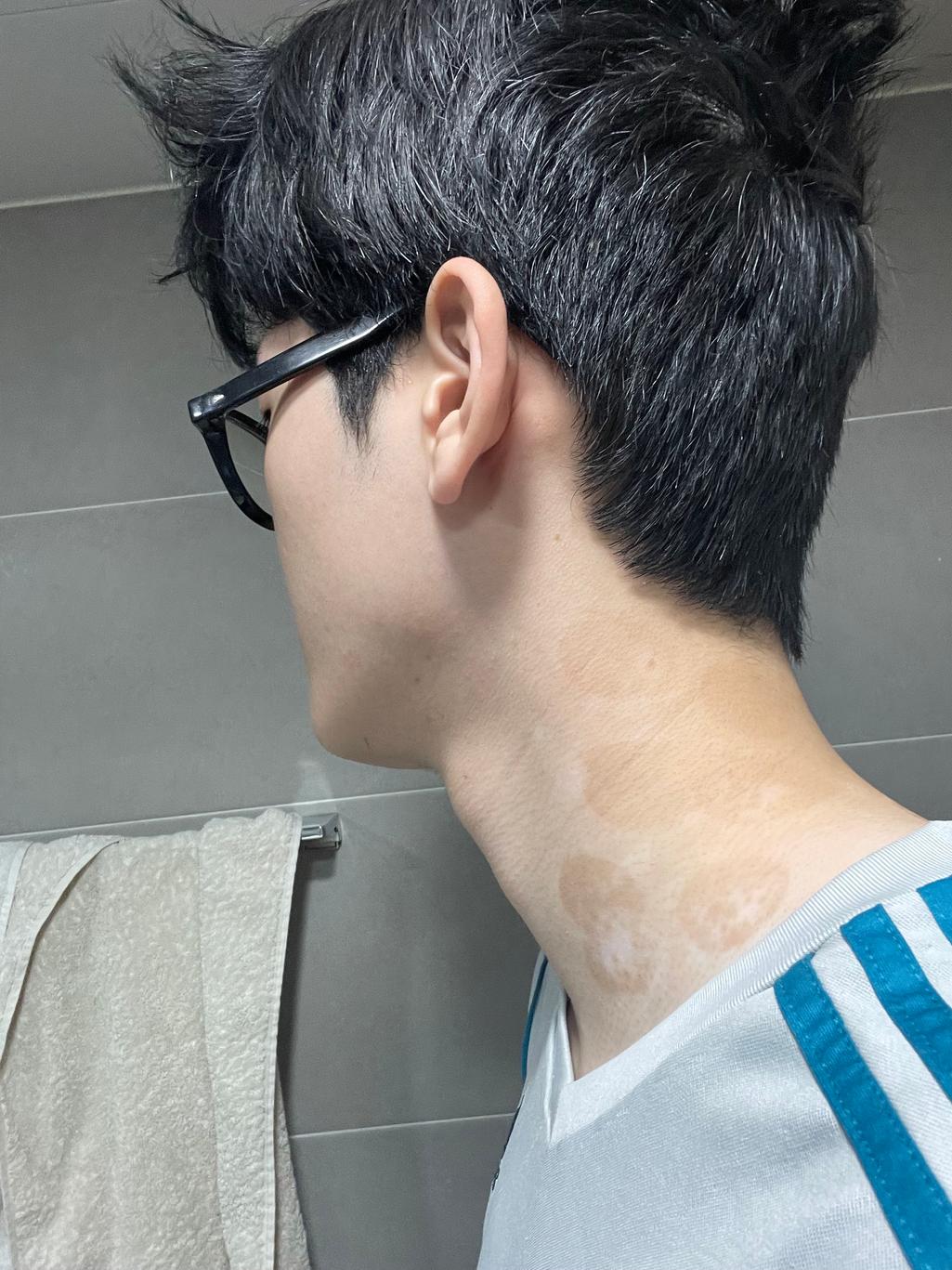 2번 째 사진