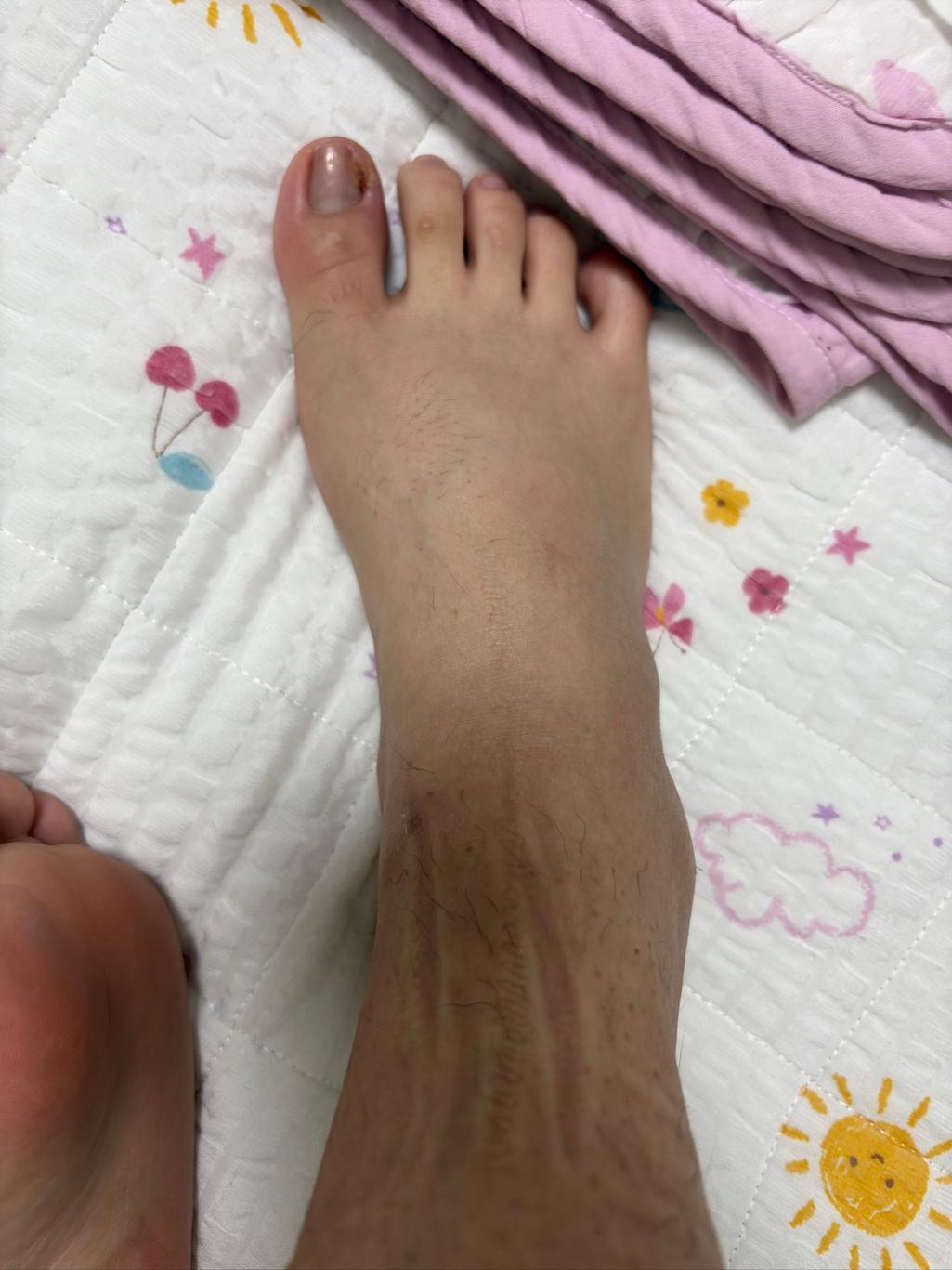 2번 째 사진