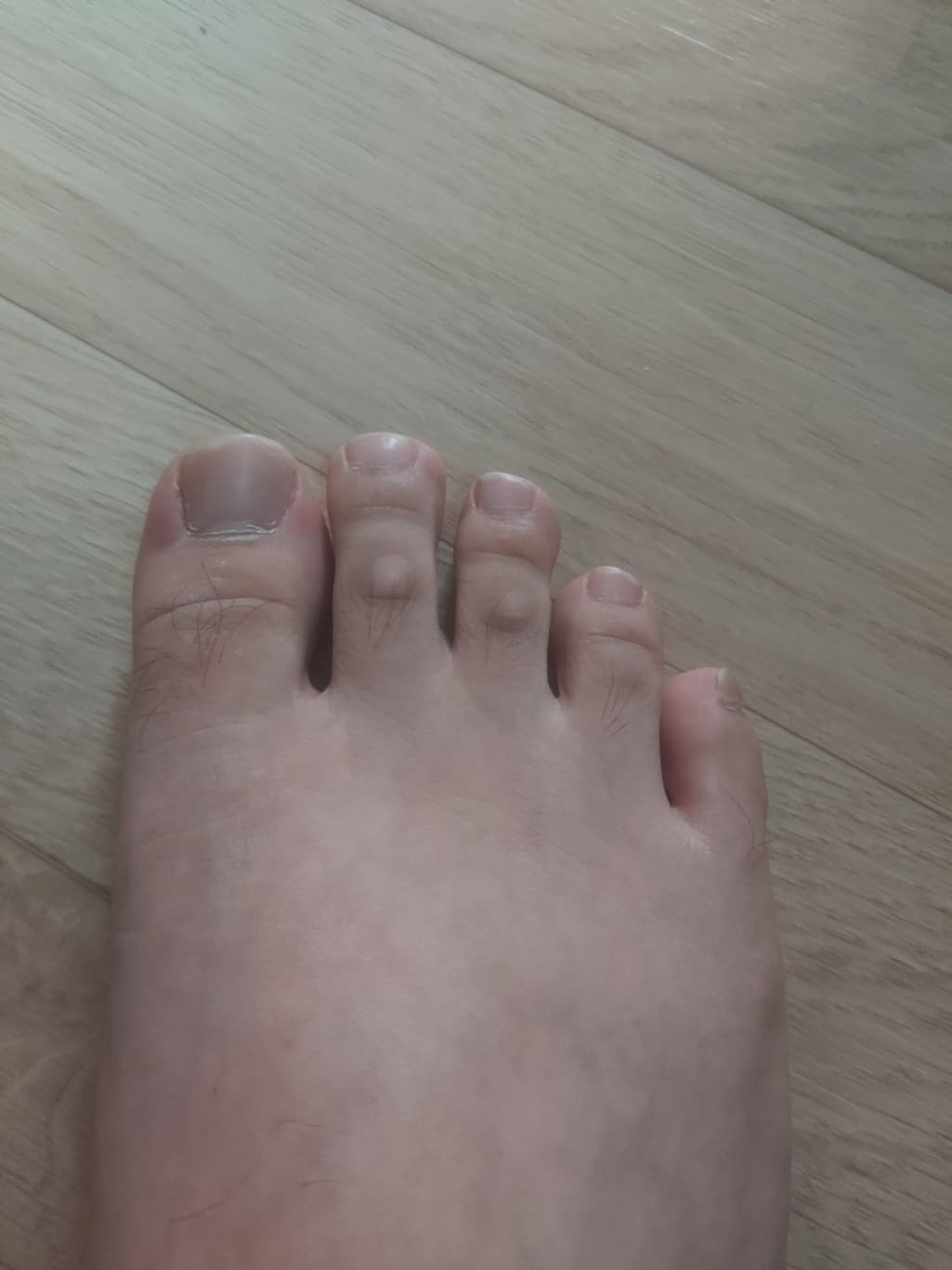 2번 째 사진