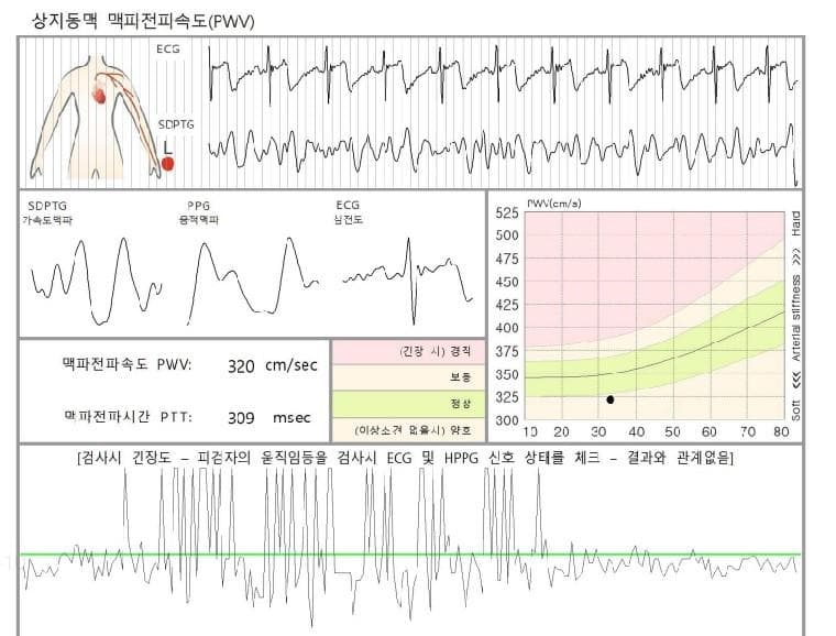 3번 째 사진