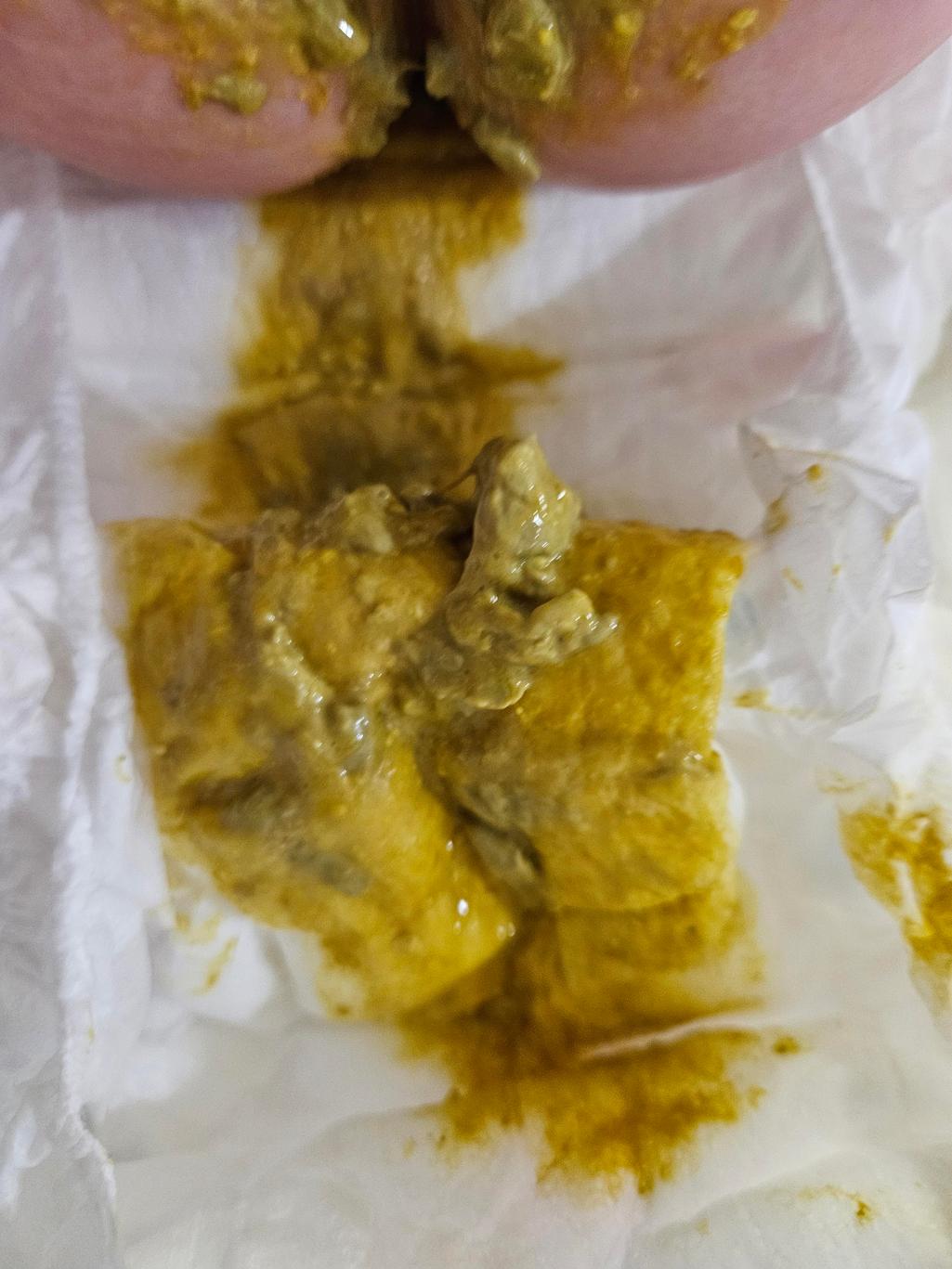 2번 째 사진