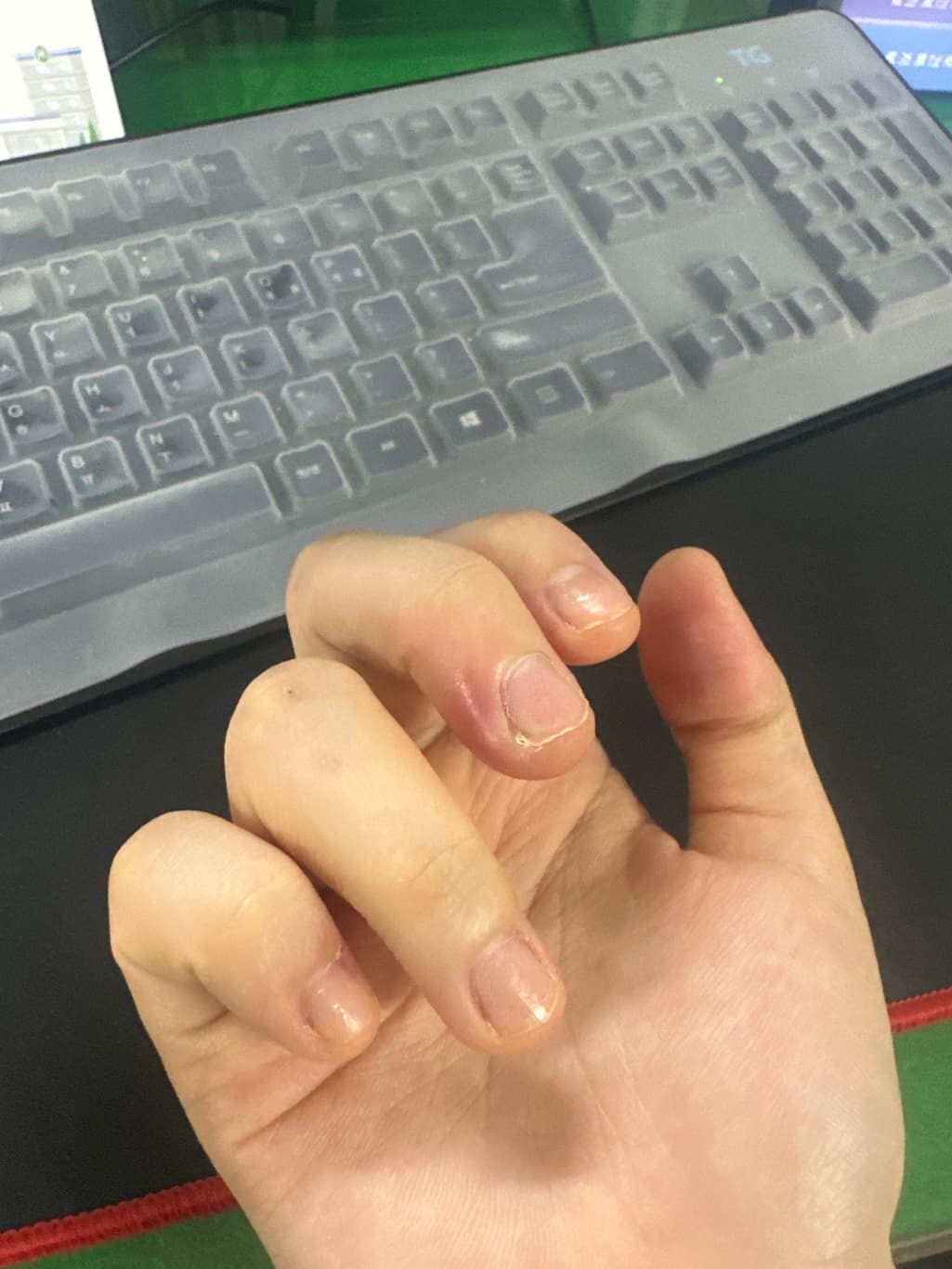 1번 째 사진