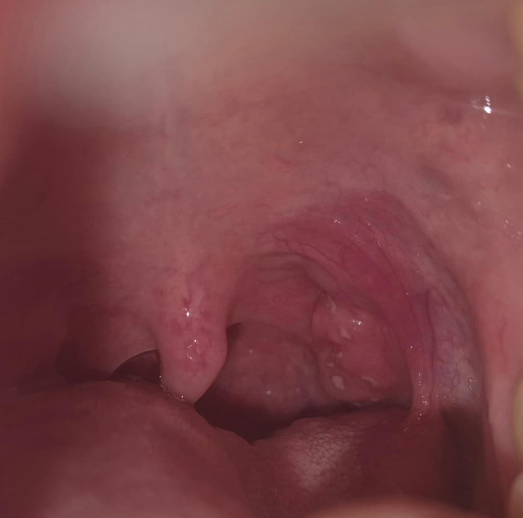 2번 째 사진