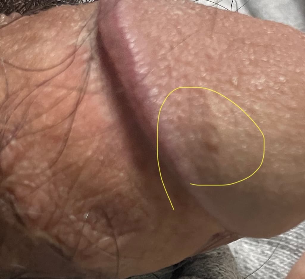 3번 째 사진