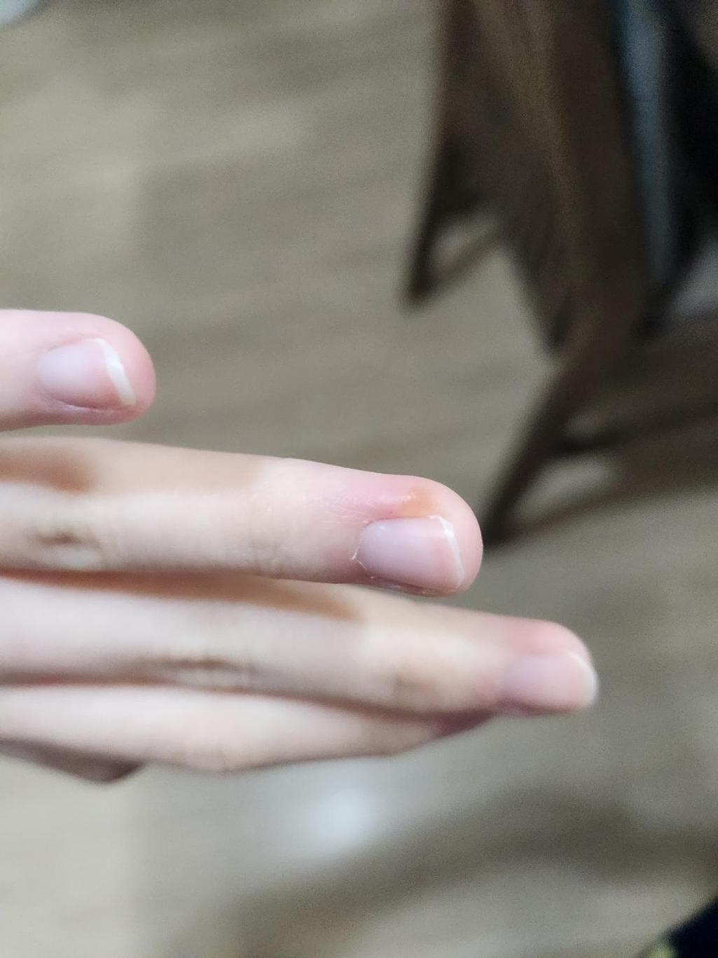 3번 째 사진
