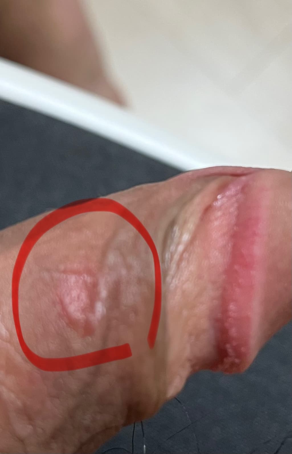 3번 째 사진