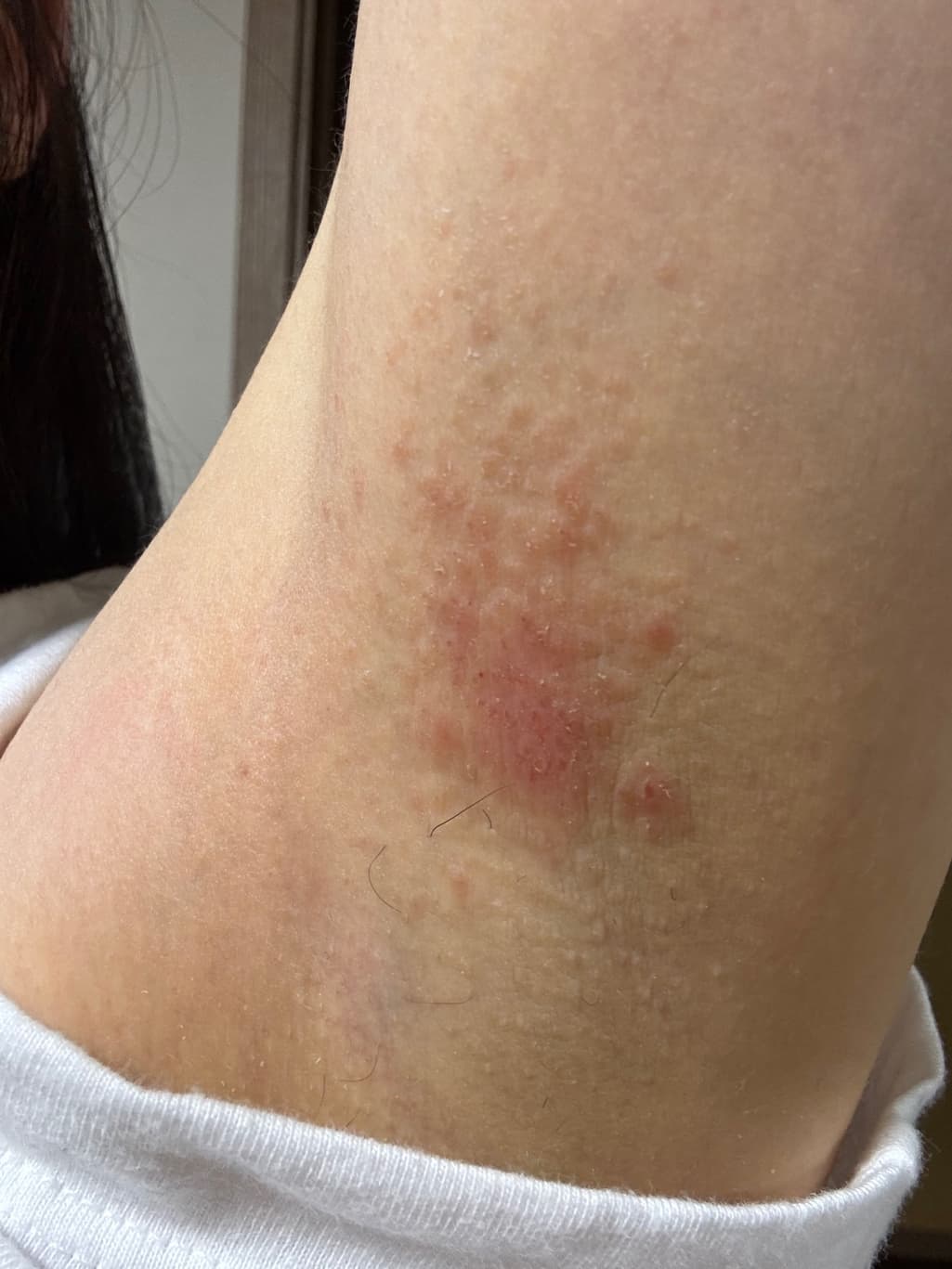 2번 째 사진