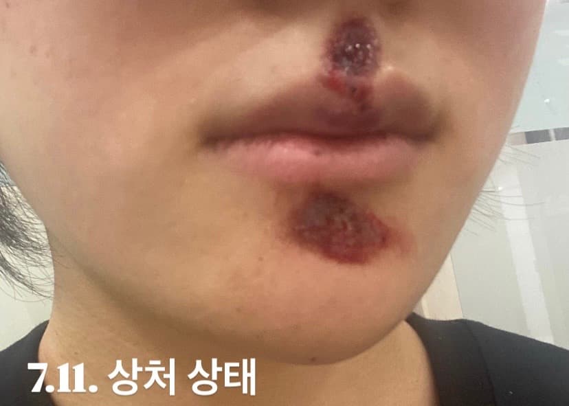 3번 째 사진