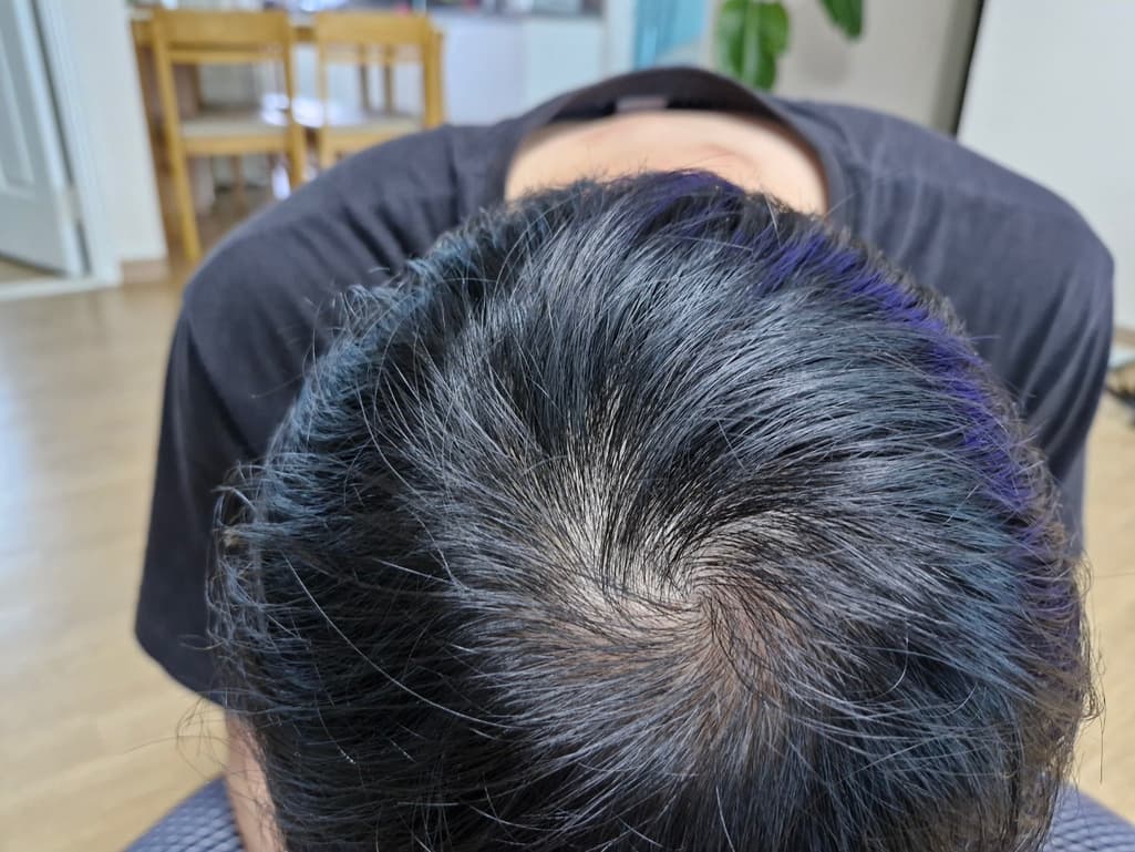 1번 째 사진