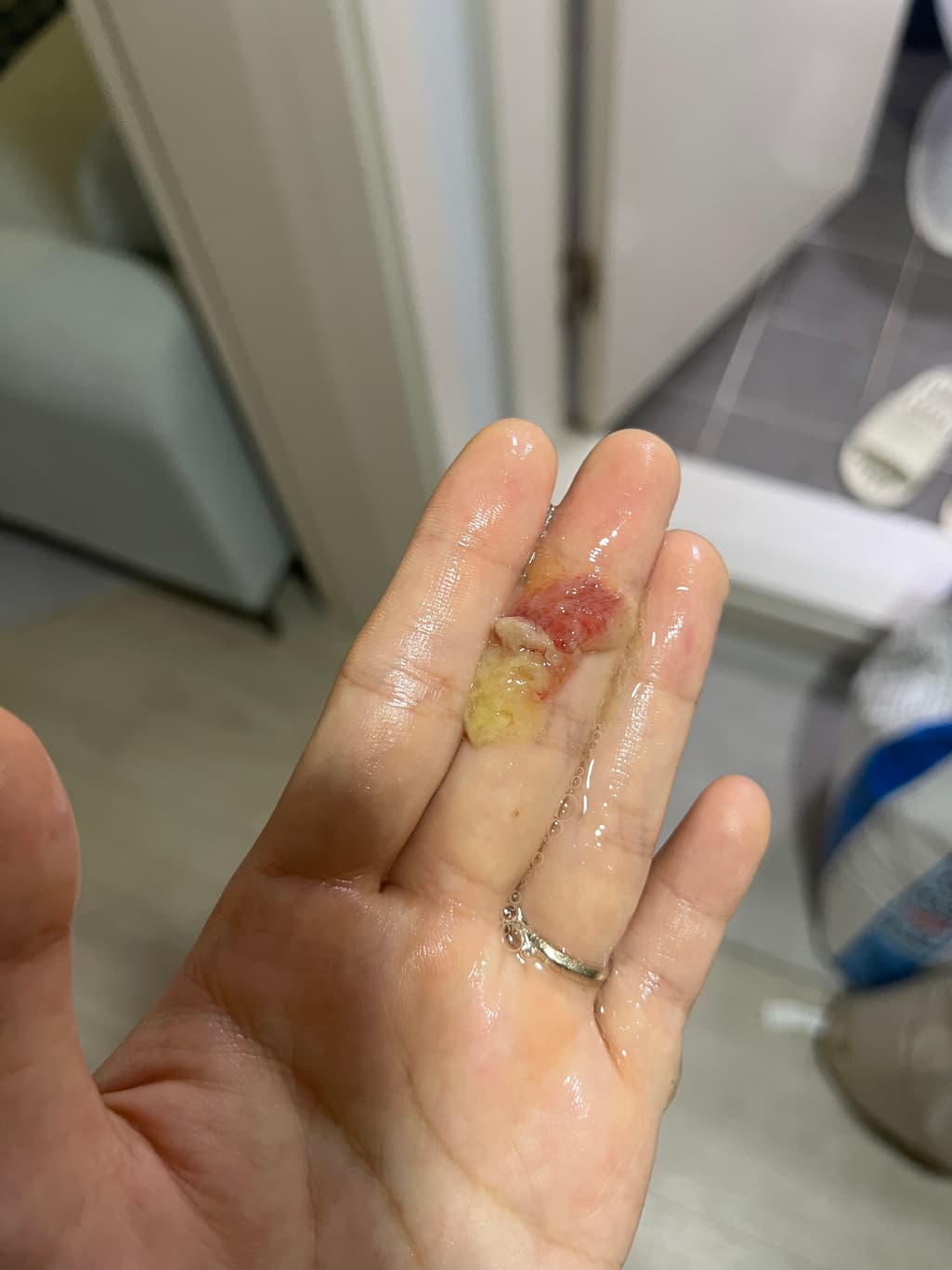 1번 째 사진