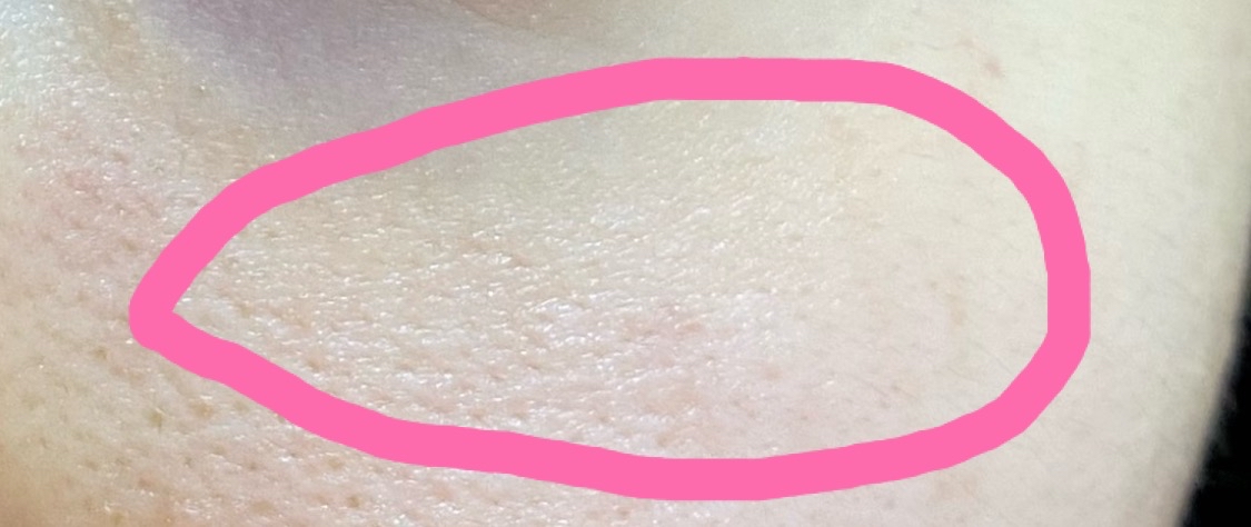 2번 째 사진