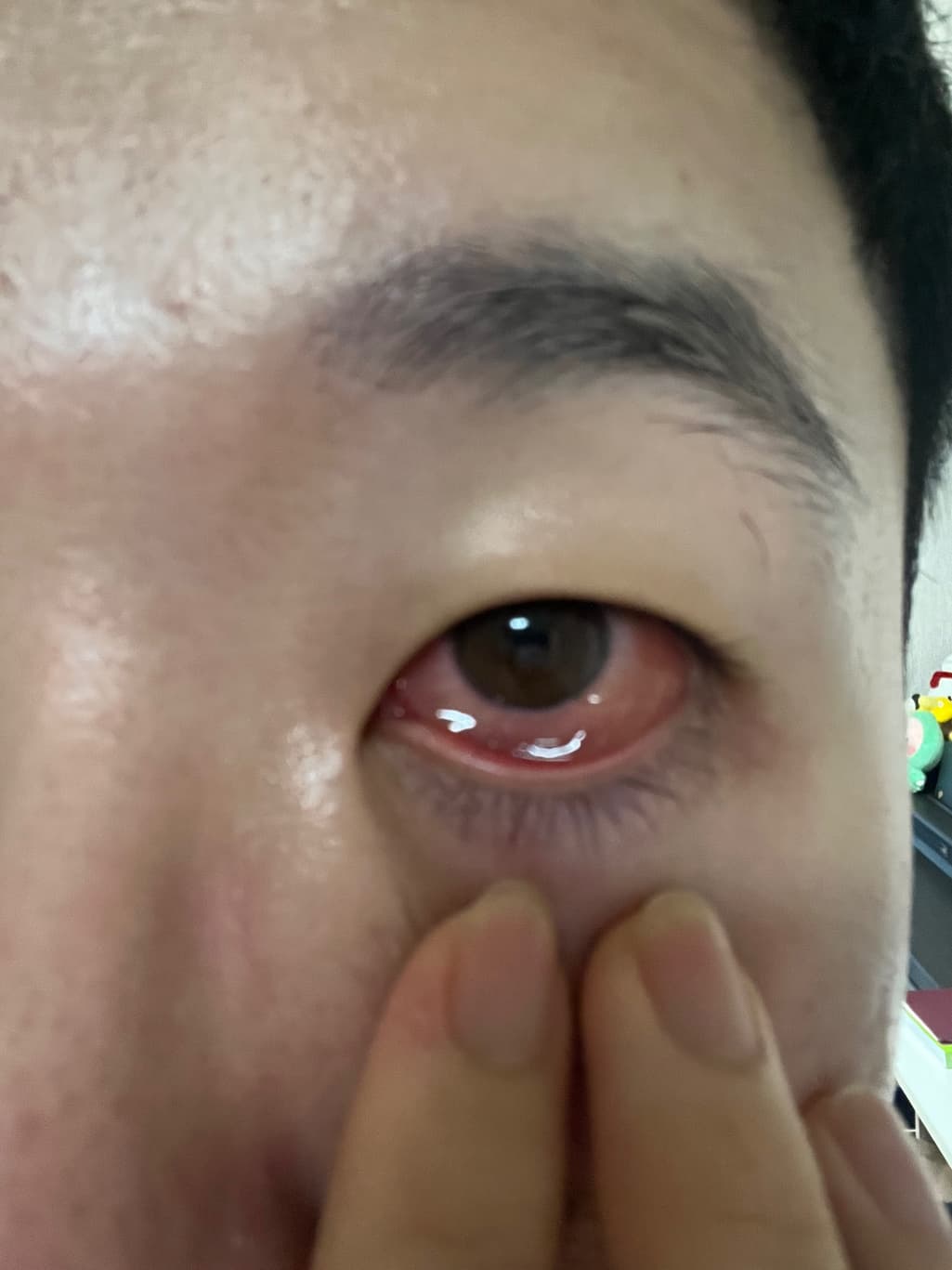 2번 째 사진