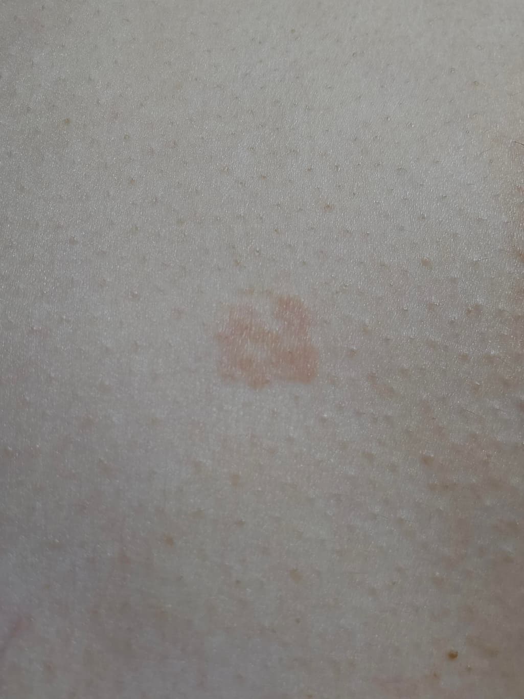 2번 째 사진