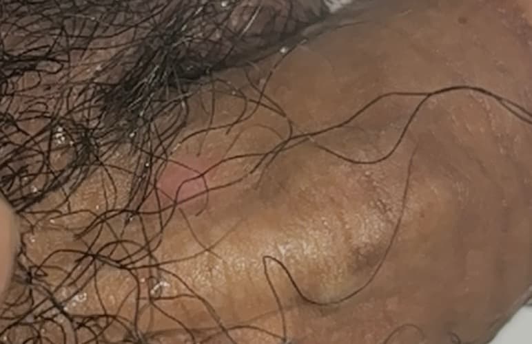 2번 째 사진