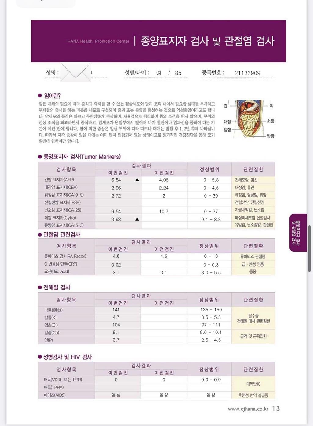 2번 째 사진