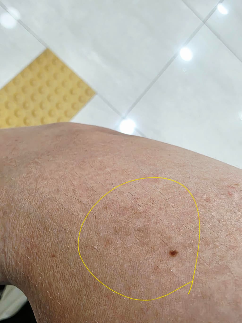 3번 째 사진