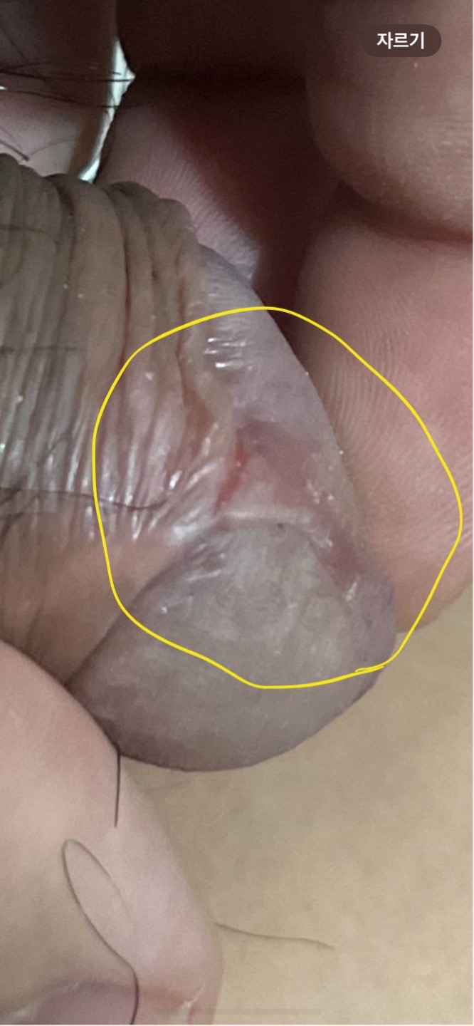 2번 째 사진