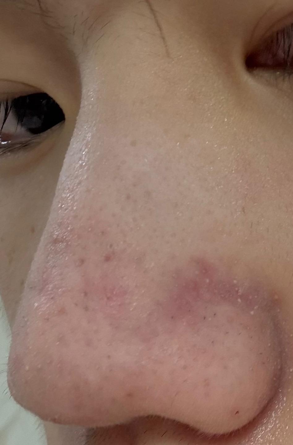 2번 째 사진