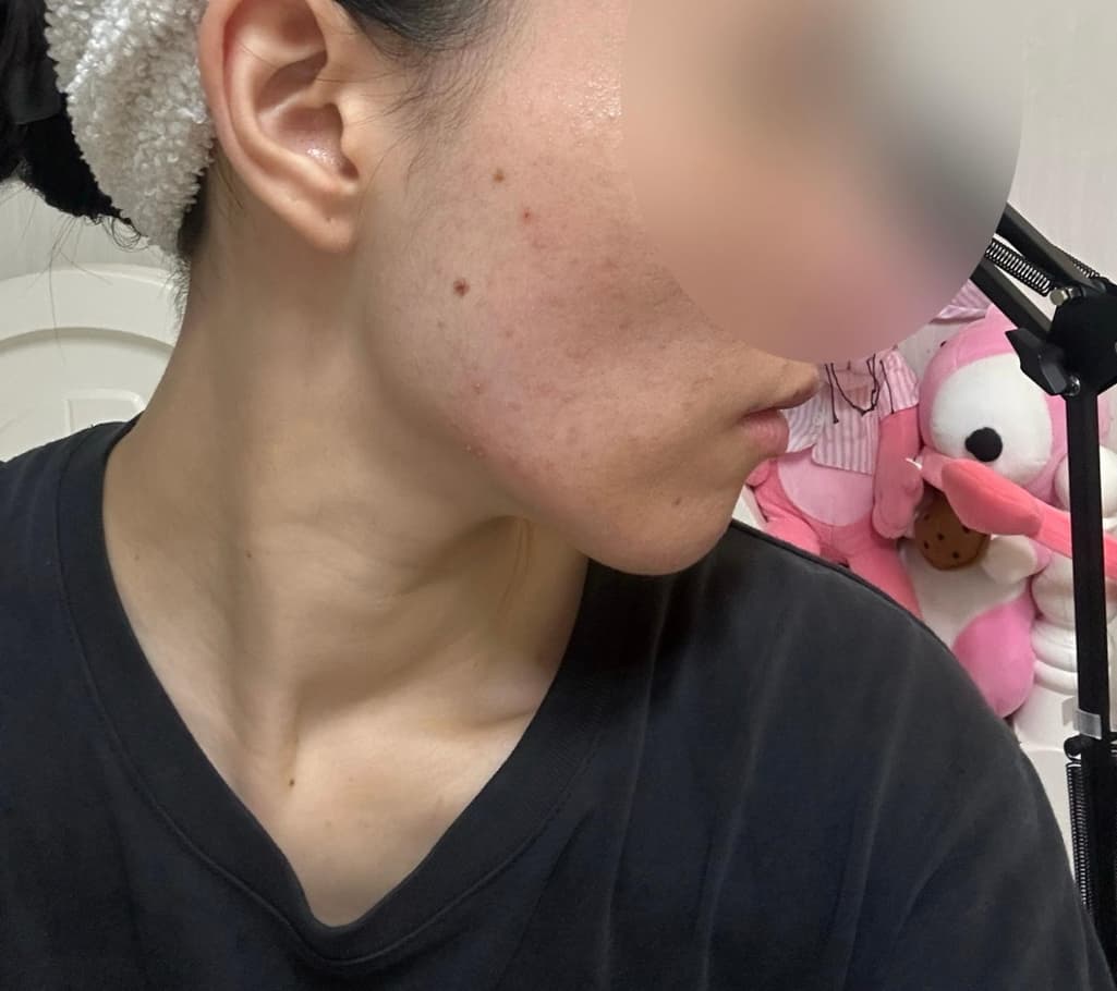 1번 째 사진