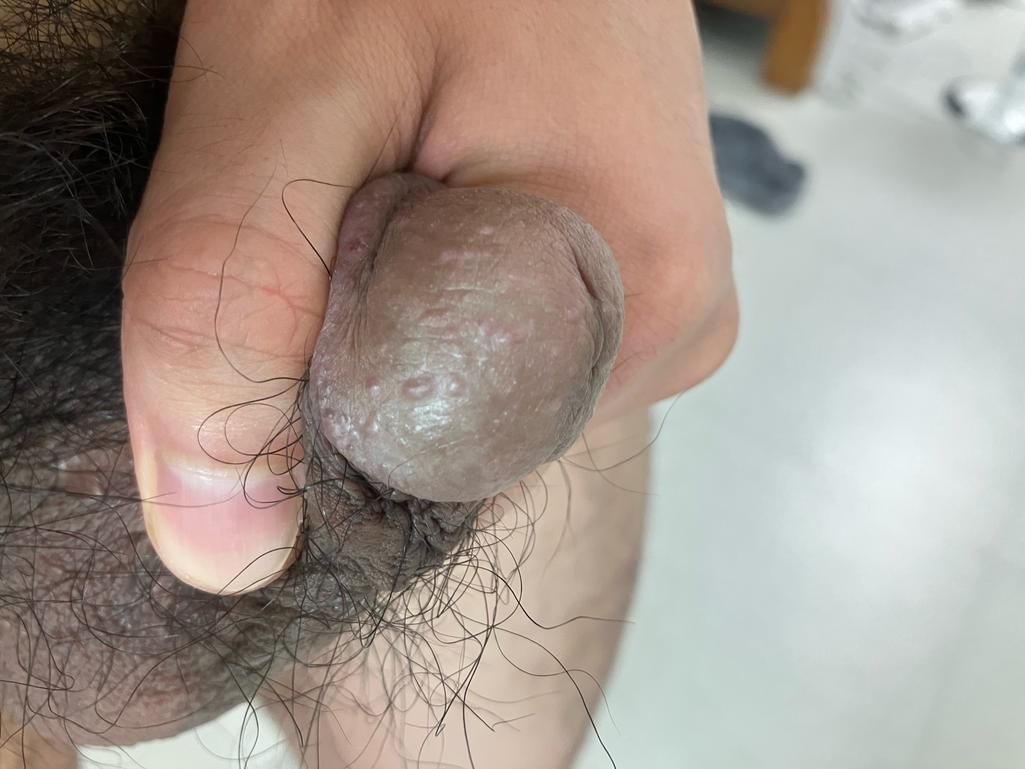 2번 째 사진