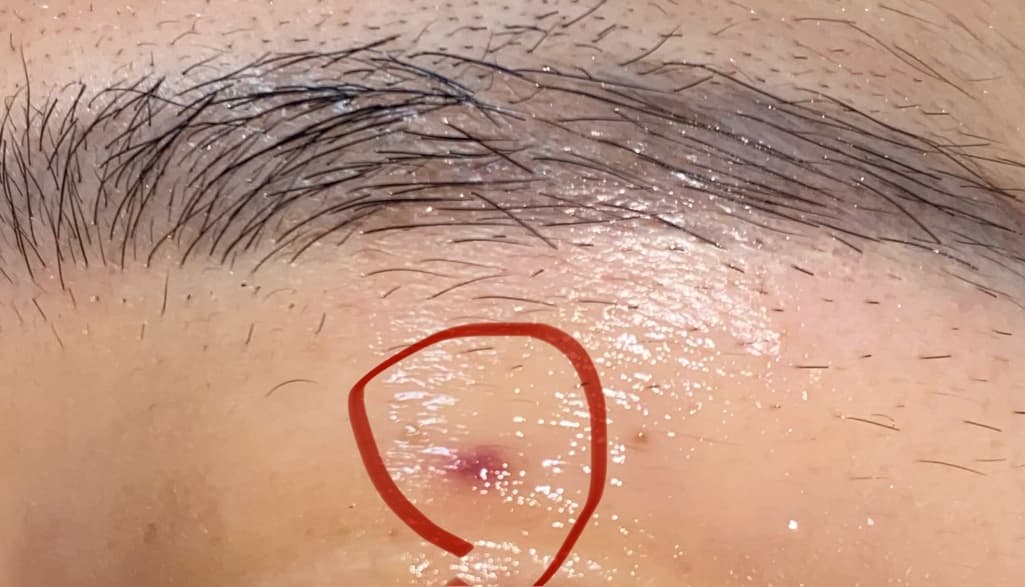 1번 째 사진