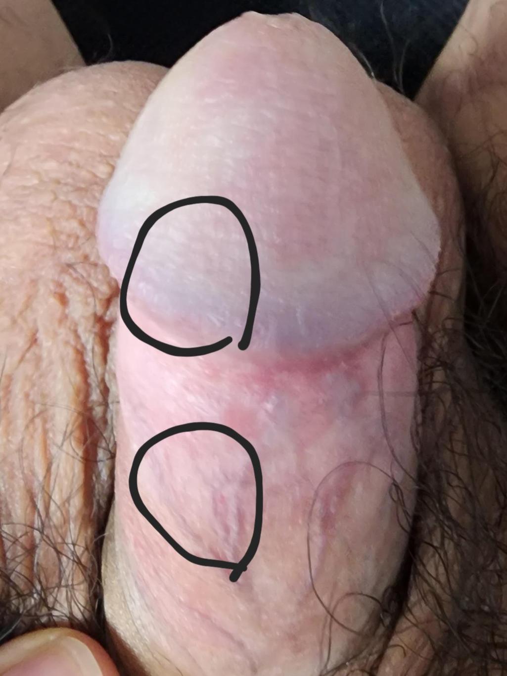2번 째 사진