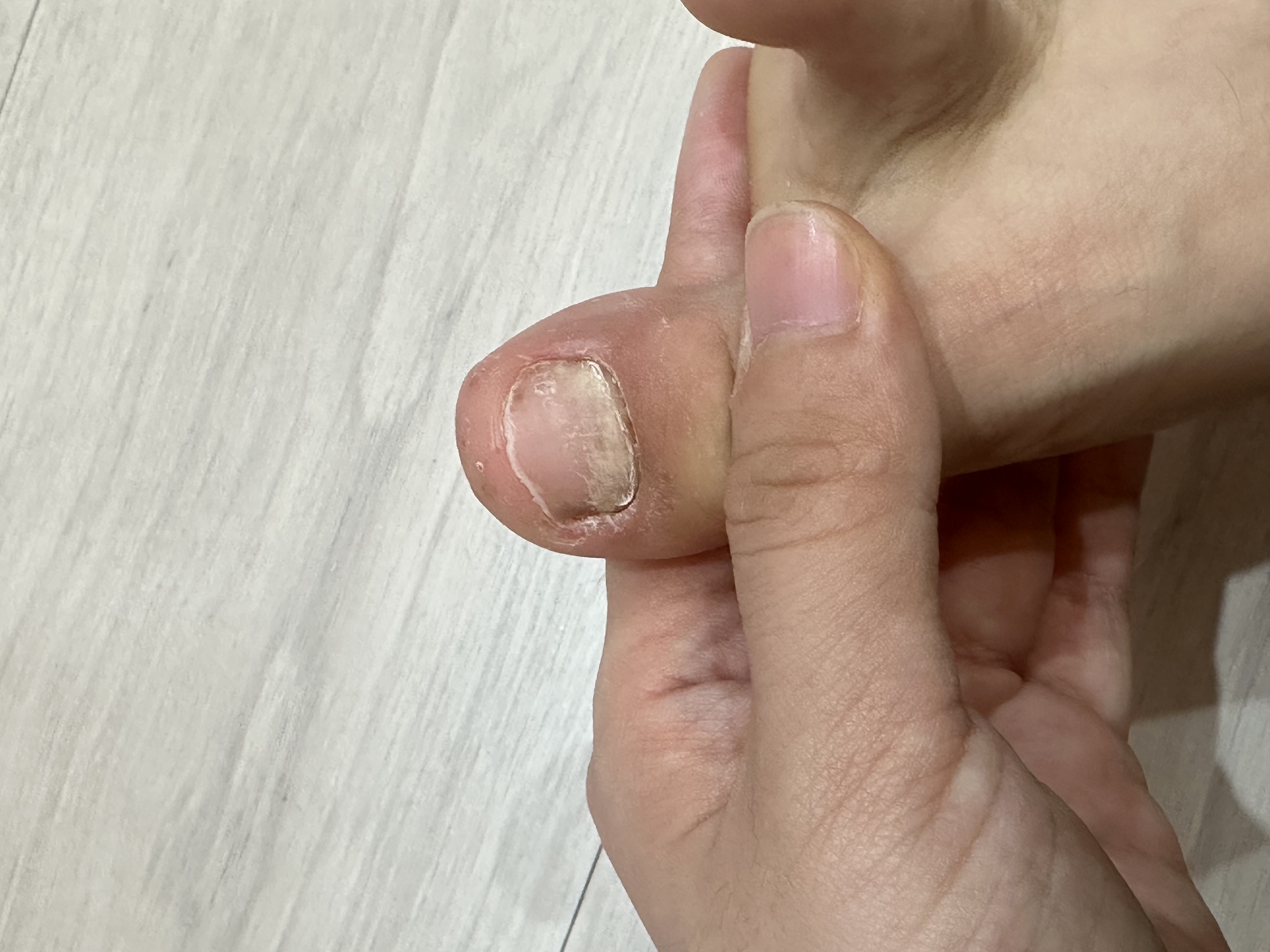 2번 째 사진