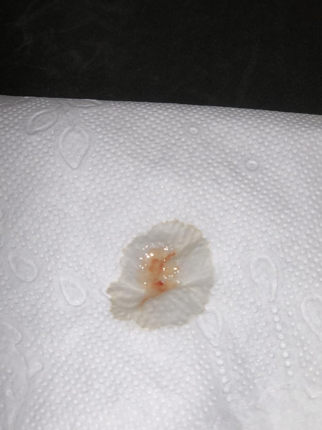 2번 째 사진