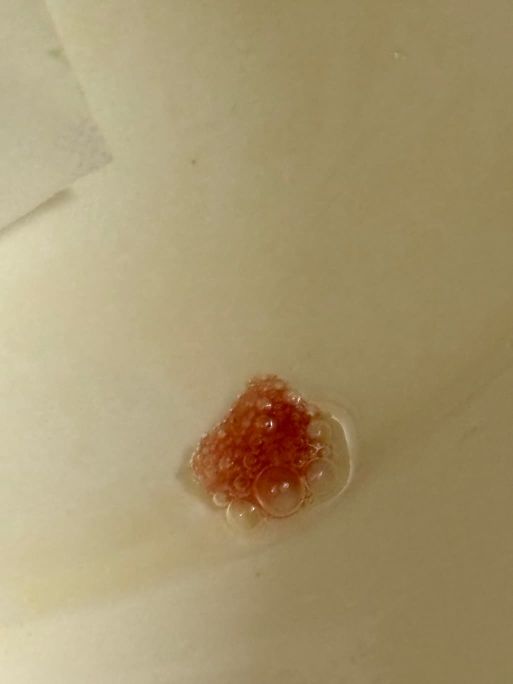 2번 째 사진