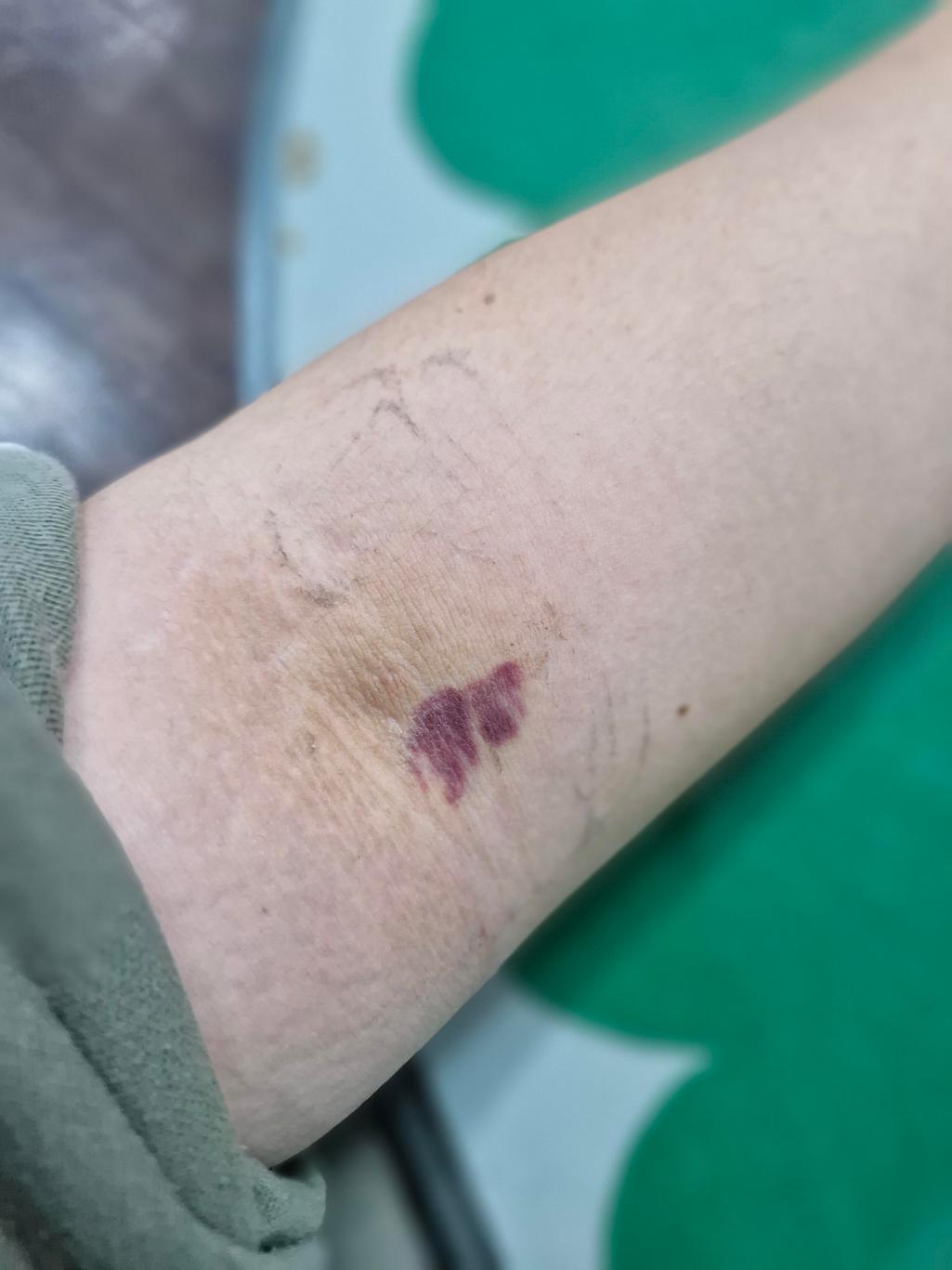 1번 째 사진