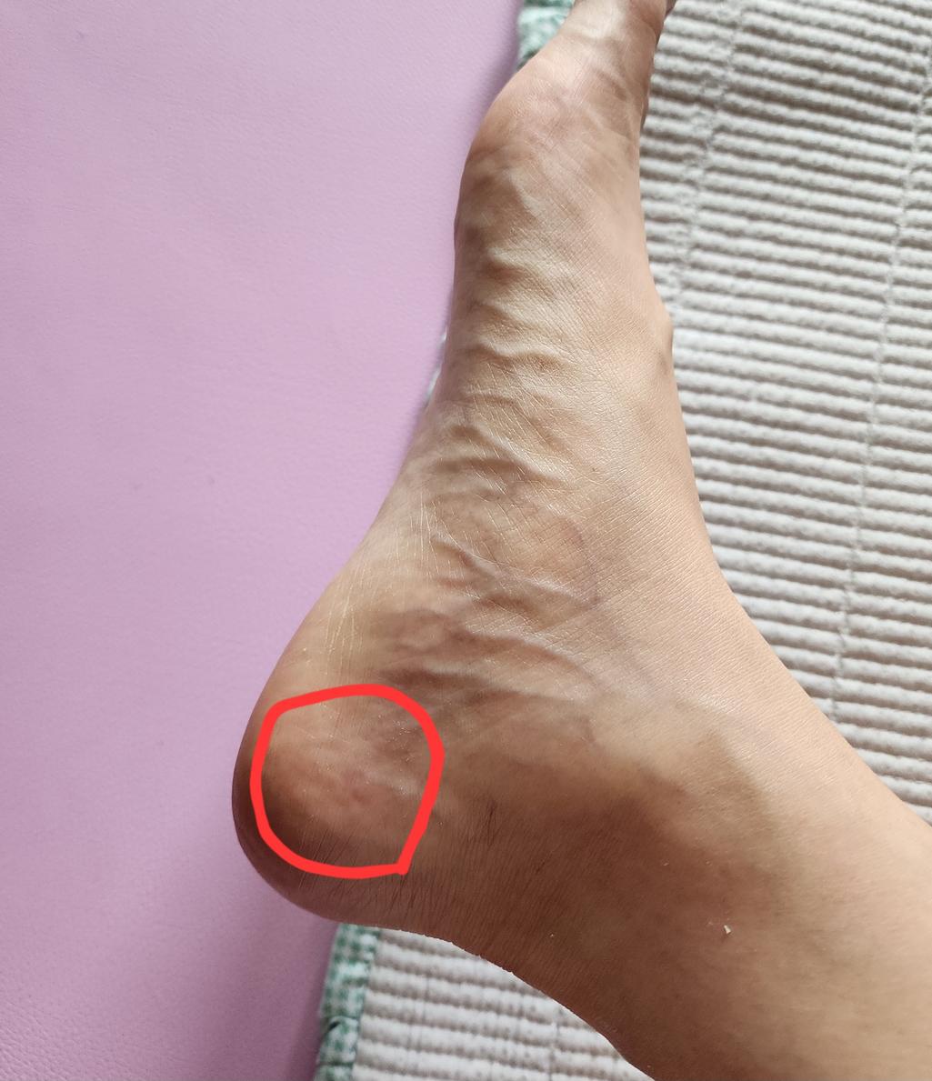 2번 째 사진
