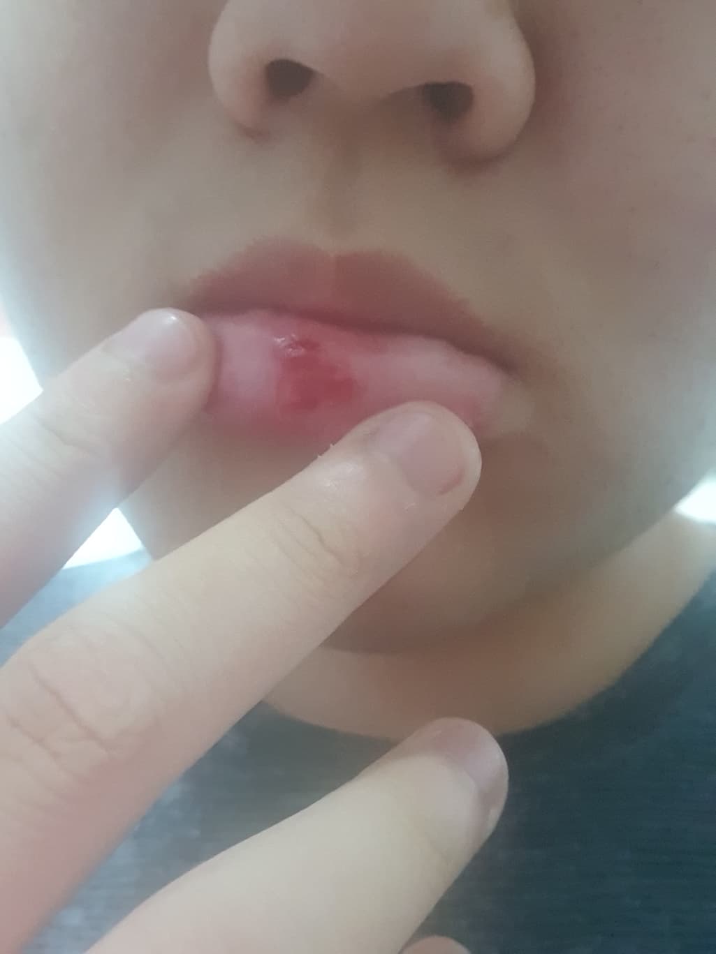 1번 째 사진
