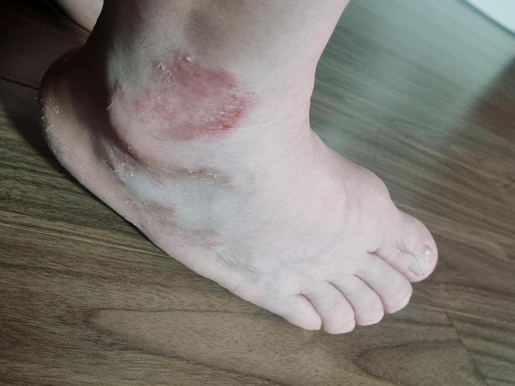 2번 째 사진