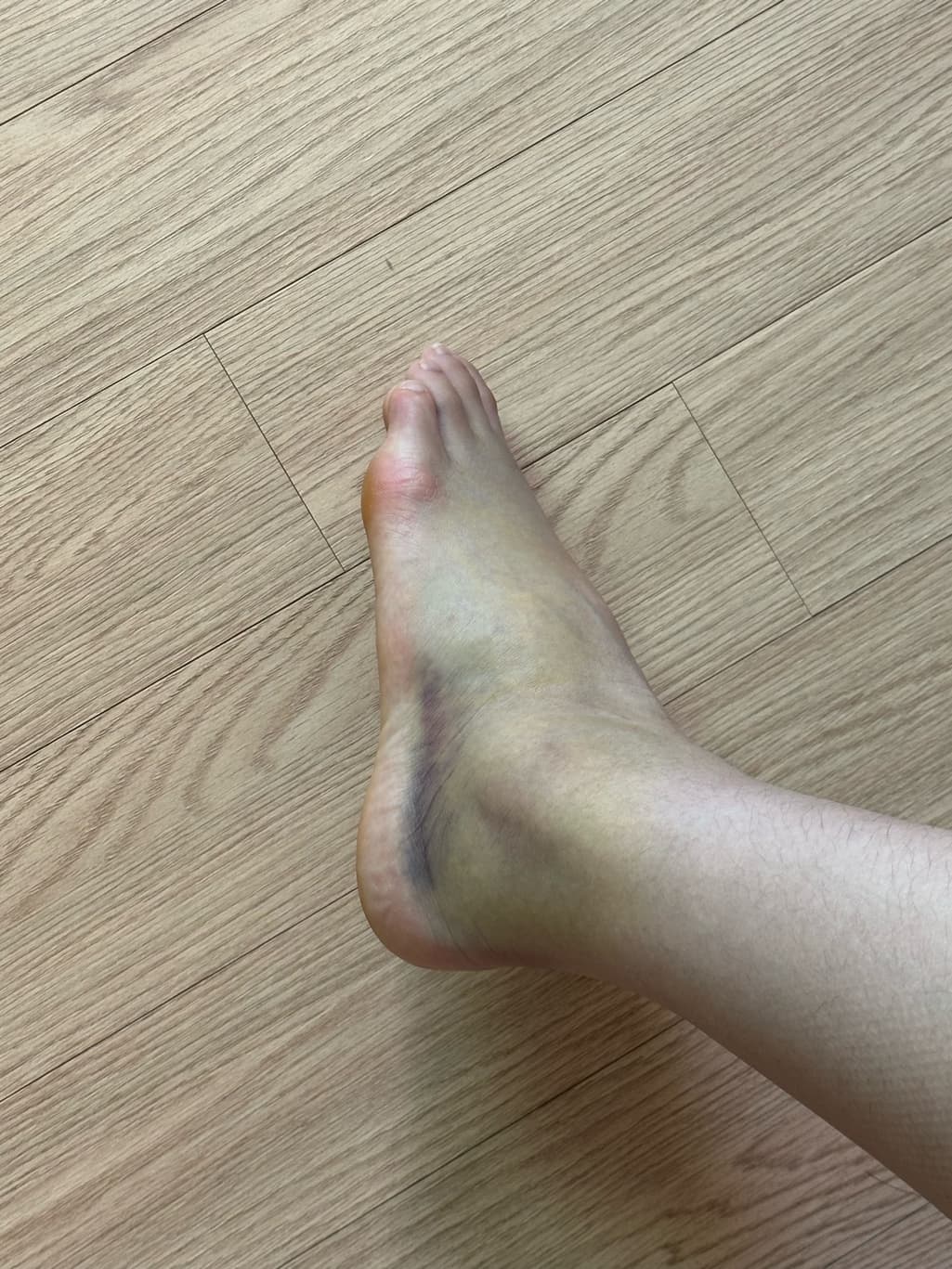2번 째 사진