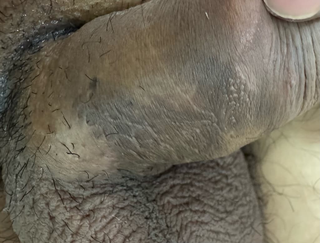 7번 째 사진