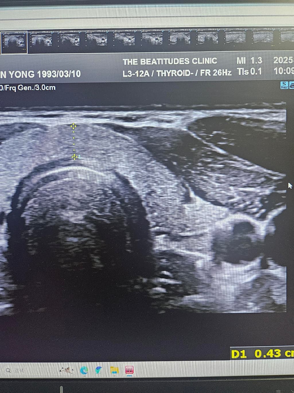 2번 째 사진