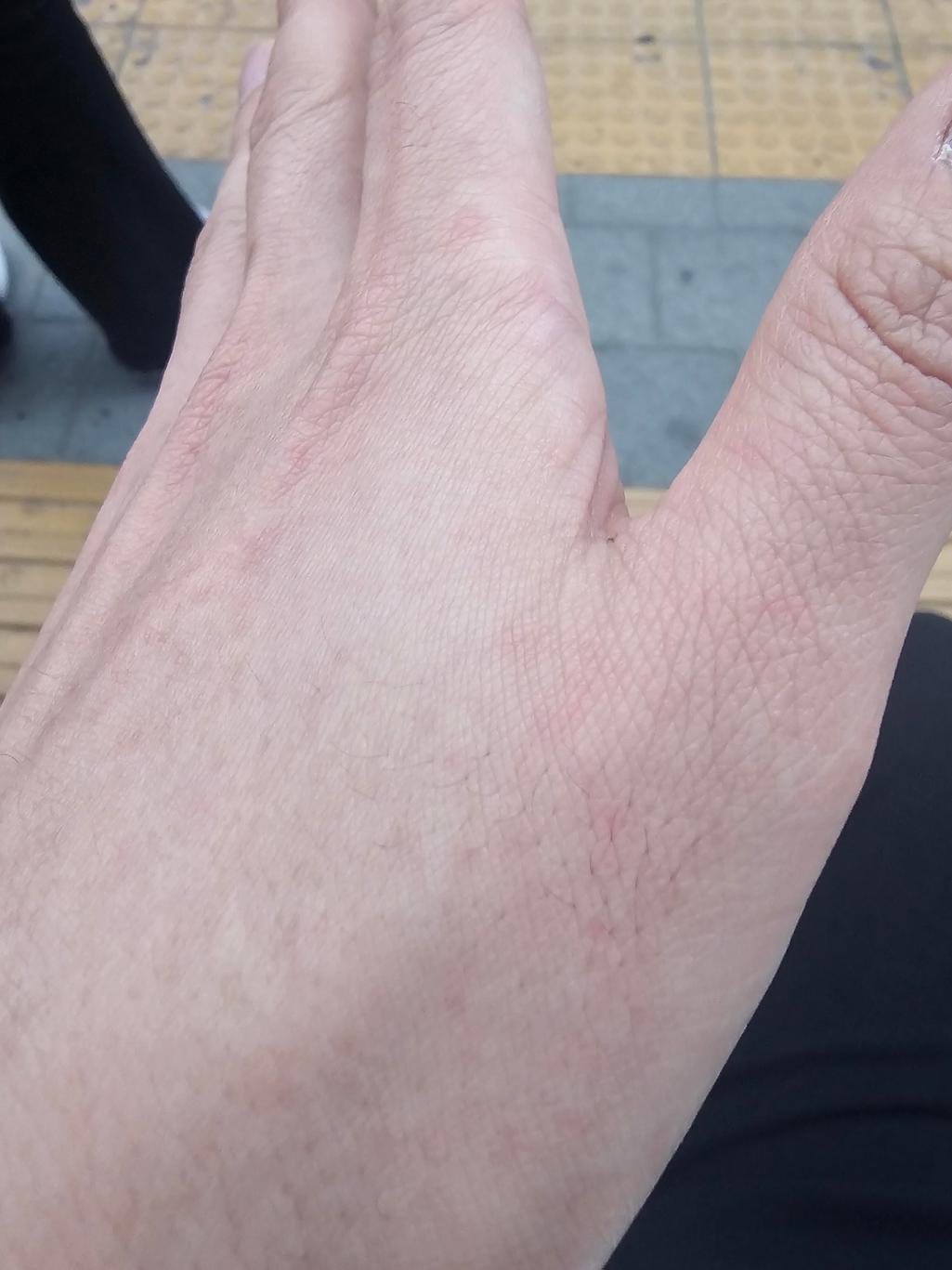 2번 째 사진