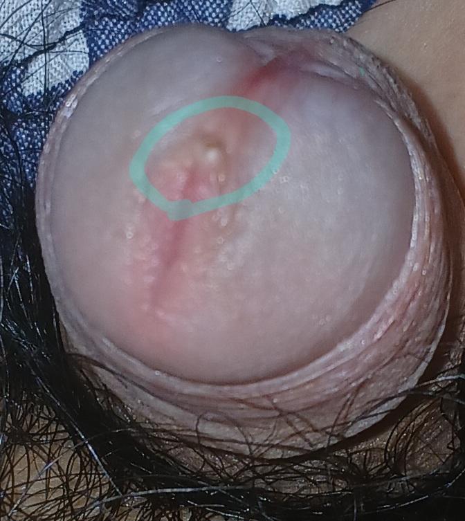2번 째 사진