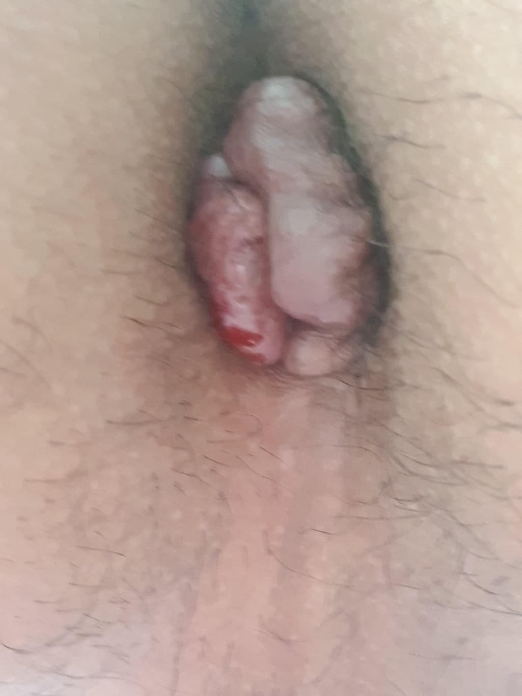 2번 째 사진