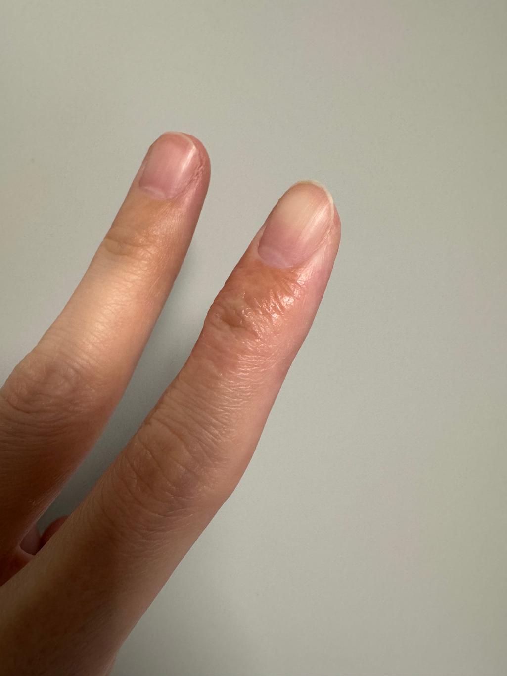 2번 째 사진
