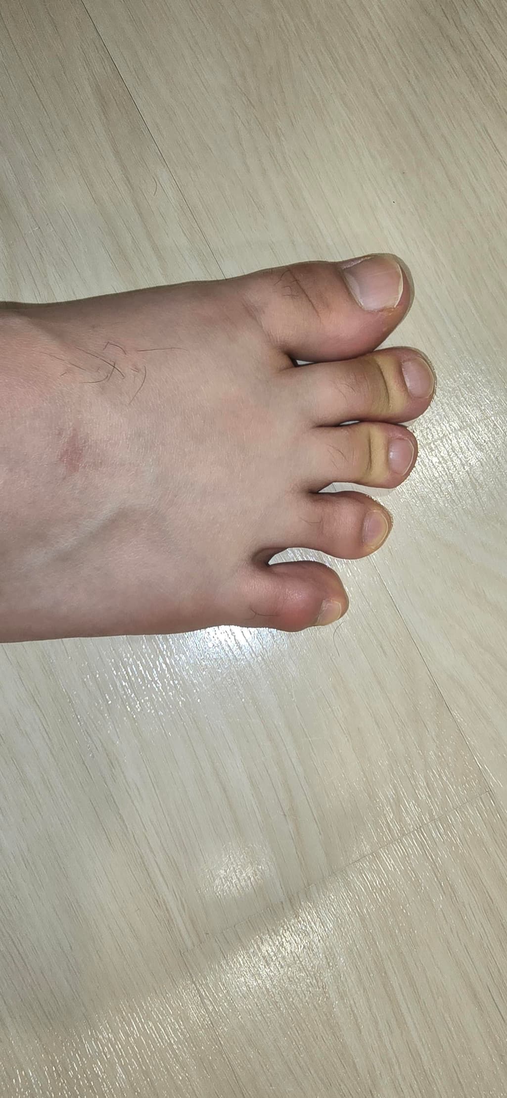 2번 째 사진